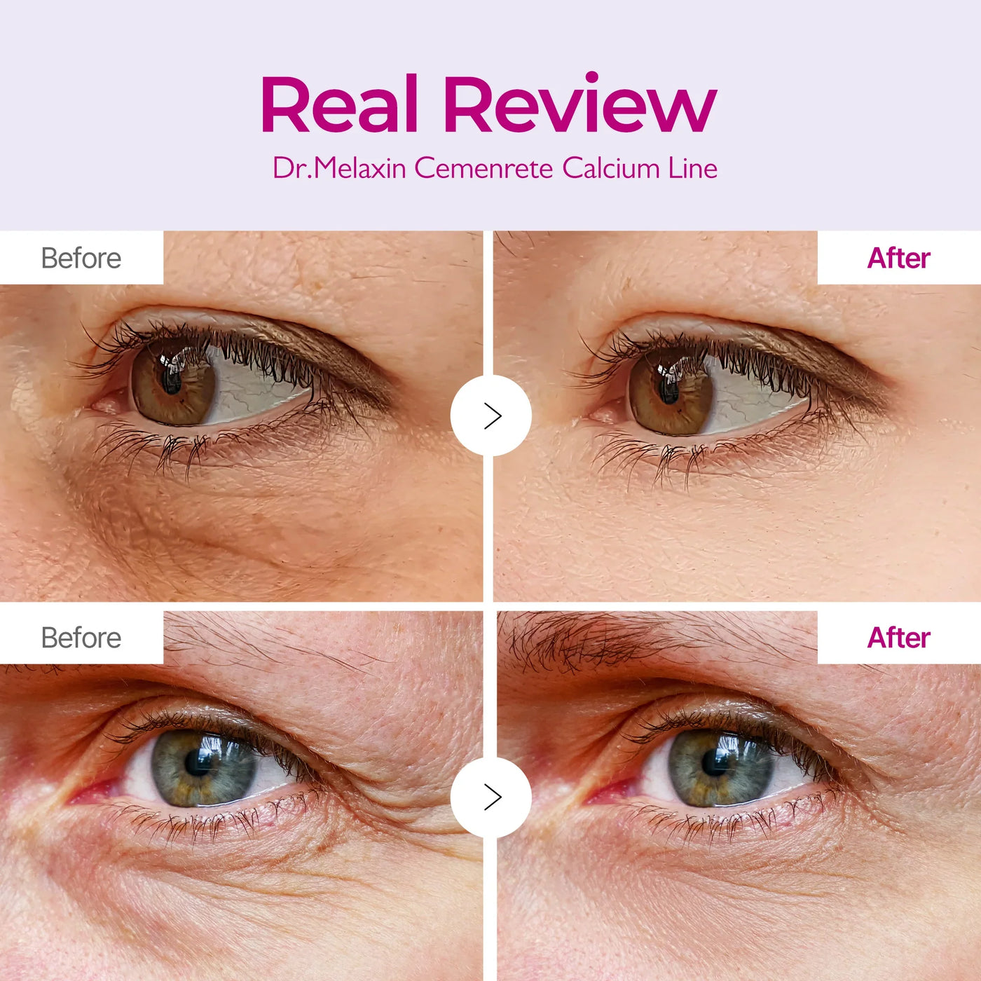 Dr Melaxin™ Cemenrete Calcium Volume Eye patch