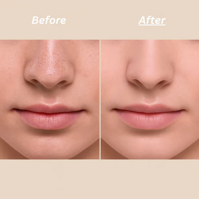 Dr Melaxin™ Peel Shot Ampoule (Extra 65% Off 🎉)