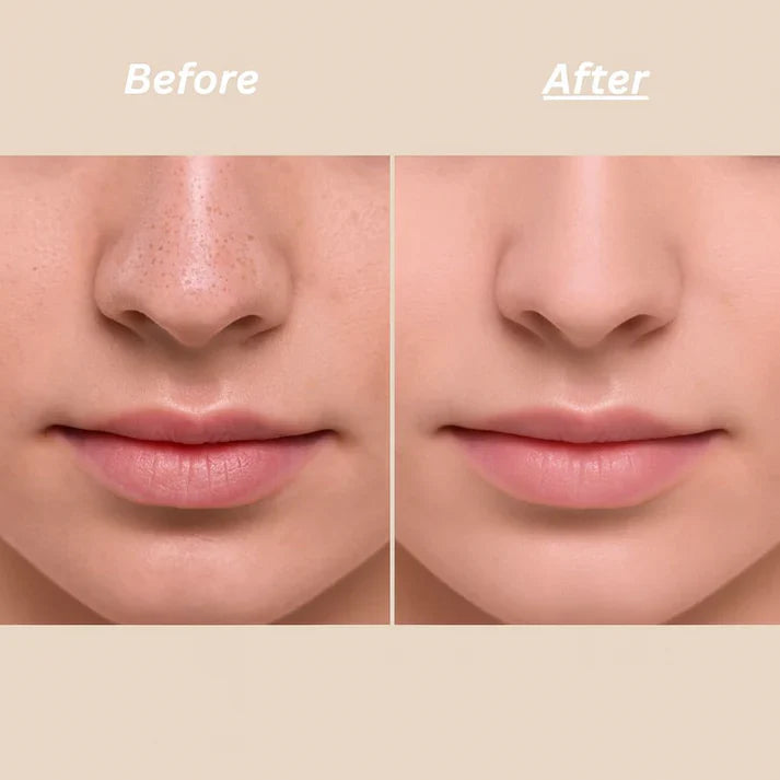 Dr Melaxin™ Peel Shot Ampoule [BLACK FRIDAY SALE!]